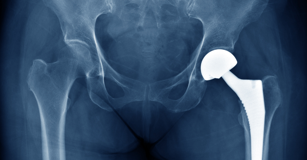 Total Hip Replacement - Jackson Animal Hospital